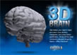 3D Brain image